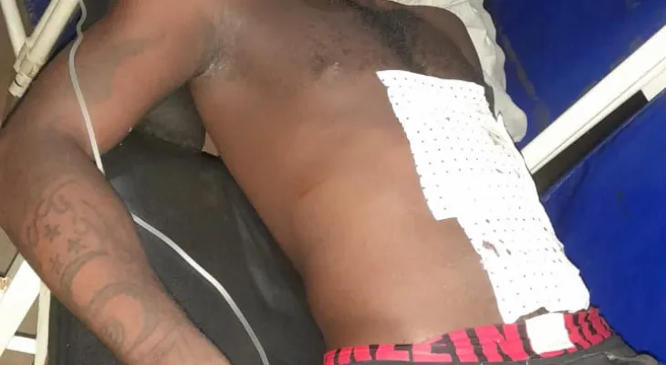 Motorist attacked with short-gun battles for Life